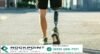 Pre-Settlement Funding for Amputation Injury Lawsuits – Rockpoint Legal Funding