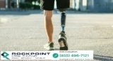 Pre-Settlement Funding for Amputation Injury Lawsuits – Rockpoint Legal Funding